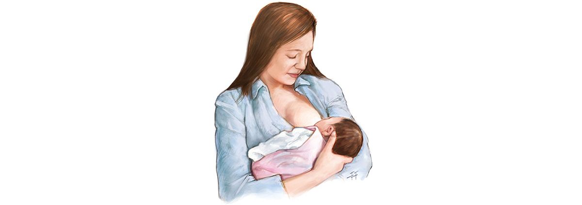 Breastfeeding and Stroke - شیردهی مادر و سکته مغزی