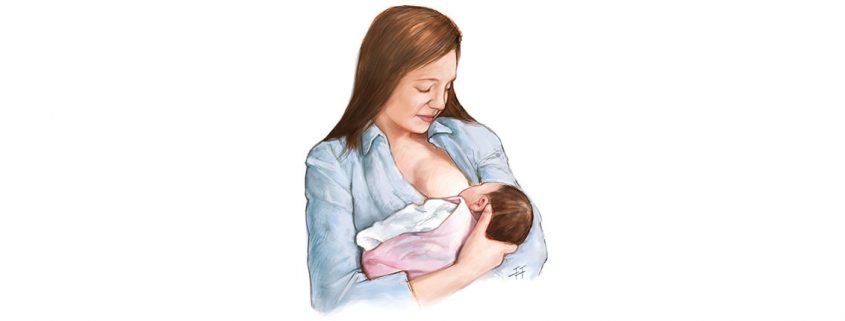 Breastfeeding and Stroke - شیردهی مادر و سکته مغزی