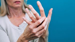 rheumatoid arthritis 03
