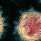 SARS-CoV-2 viral load peaks in the early stages of disease - بر خلاف انتظار بیشترین بار ویروس کرونا در مراحل ابتدایی و کم علامت ابتلا به بیماری است