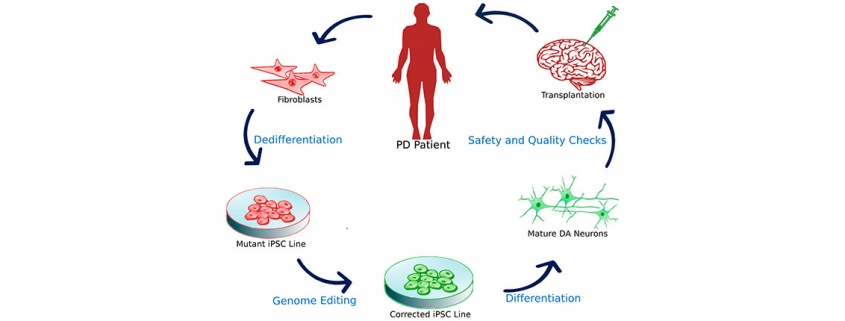 New approach against Parkinson’s disease through stem cell research - سلول های بنیادی به کمک درمان پارکینسون می آیند