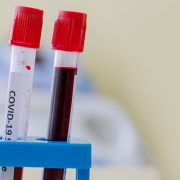 Possible Link Between Blood Type and COVID-19 Susceptibility and Severity - گروه خونی ممکن است در شدت ابتلا به کووید19 موثر باشد