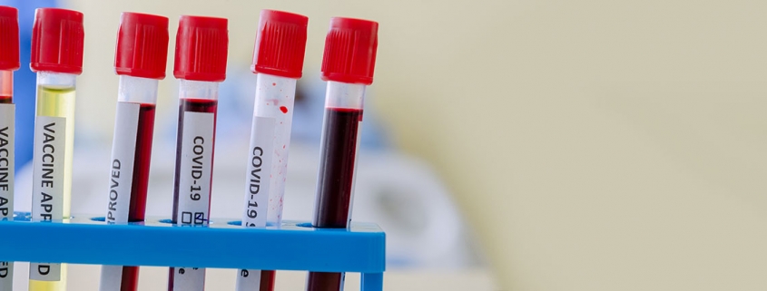 Possible Link Between Blood Type and COVID-19 Susceptibility and Severity - گروه خونی ممکن است در شدت ابتلا به کووید19 موثر باشد