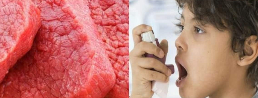 Increased Meat Consumption Associated With Symptoms of Childhood Asthma - مصرف زیاد گوشت قرمز باعث تشدید علایم آسم در کودکان میگردد