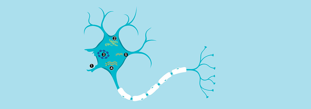 ALS neuron damage reversed with new compound - امیدهای تازه برای درمان بیماری ALS