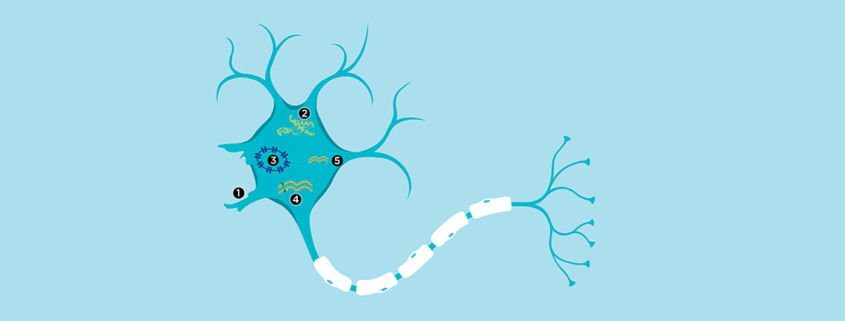 ALS neuron damage reversed with new compound - امیدهای تازه برای درمان بیماری ALS