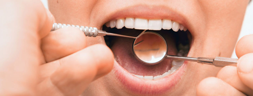 Periodontal disease increases risk of major cardiovascular events - اهمیت بهداشت دهان درسلامت قلبی عروقی