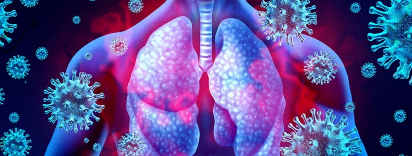 Lung Damage May Persist Long After COVID19 Pneumonia - ماندگاری آسیب های ریوی کرونا